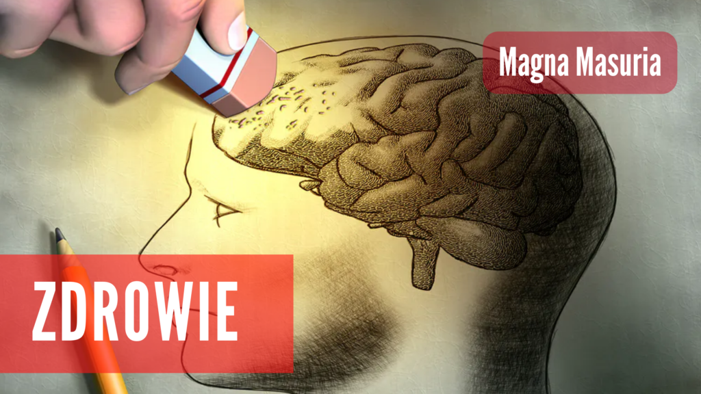 Zdrowie Choroba Alzheimera Przyczyny Objawy Metody Terapii Magna Masuria